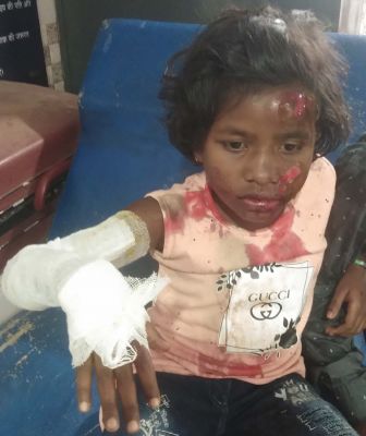 अलग-अलग सडक़ हादसे में बालिका सहित 3 घायल