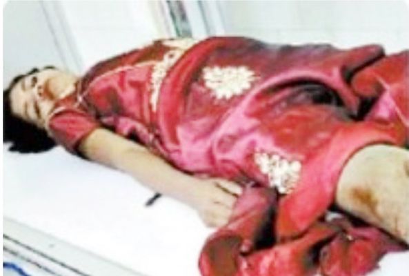 बाइक अनियंत्रित होने से गिरे  3 घायल, मेकाहारा रेफर 