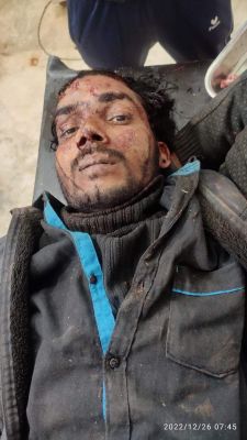 नशा करने पैसा नहीं देने पर साथी पर पत्थर से वार, मरा समझकर लूटकर फरार, जुर्म दर्ज