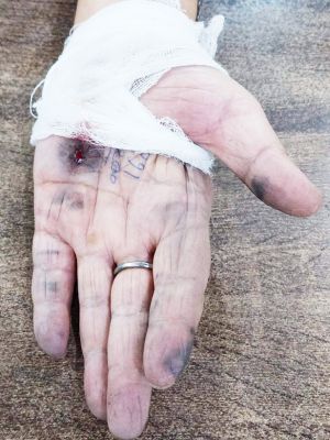 होटल के किचन गार्डन में कथित फायरिंग की खबर निकली झूठी