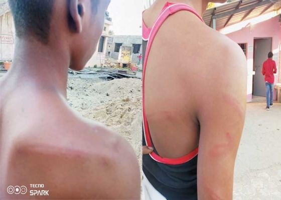  अंग्रेजी के शिक्षक ने दो छात्रों की कर दी बेदम पिटाई