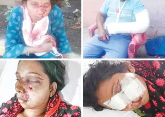 खुले में कचरा फेंकने के विवाद में मारी लाठी