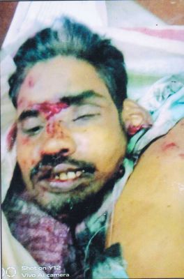 16 महीने पहले मिला अज्ञात शव पुलिस परिजनों की तलाश में