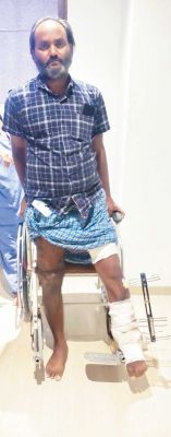 दोनों पैर की दिशा बदल चुकी थी, अब सीधा चलने लगा छन्नू