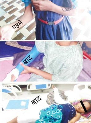 सीमा का हाथ अब सीधा हो पाएगा, मुड़ी हुई कोहनी से थी परेशान