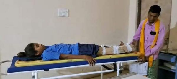 स्कूल के बाथरूम के चेंबर में छात्रा का  फंसा पैर, भर्ती