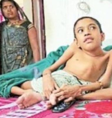 अपने हाथों से एक मच्छर भी नहीं उड़ा सकता 14 साल का महेंद्र