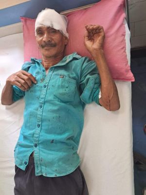 तेंदूपत्ता तोडऩे गये ग्रामीण पर भालू ने  किया हमला
