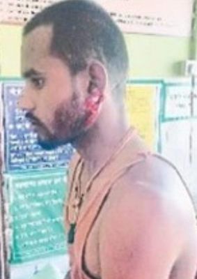 गली में पत्थर रखने के विवाद पर टंगिया से वार, दो घायल