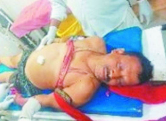 विवाद के बाद युवक पर चाकू से जानलेवा हमला