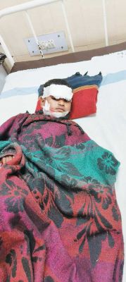 पागल कुत्ते ने किया बच्चे पर हमला, मां ने जान पर खेल बचाई जान