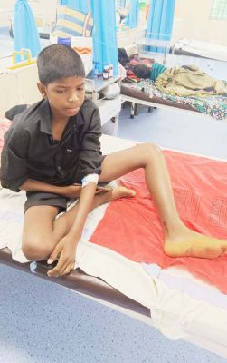 मेकाज के डॉक्टरों ने दिया सर्पदंश के 10 मरीजों को जीवनदान