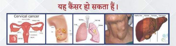 निशुल्क कैंसर जांच एवं परामर्श शिविर