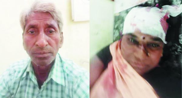 हाइवा ने मोपेड को मारी टक्कर, दंपत्ति घायल