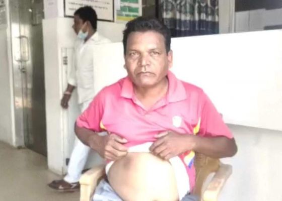 जिला अस्पताल के कैम्पस में कर्मी को लगी गोली