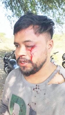 शराब न देने से नाराज कोचिया ने सेल्समैन की कर दी पिटाई