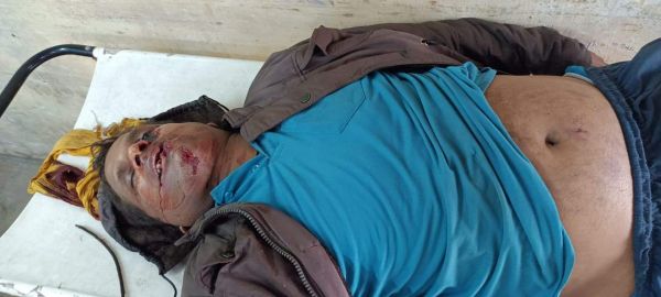 अज्ञात वाहन की ठोकर से ग्रामीण की मौत