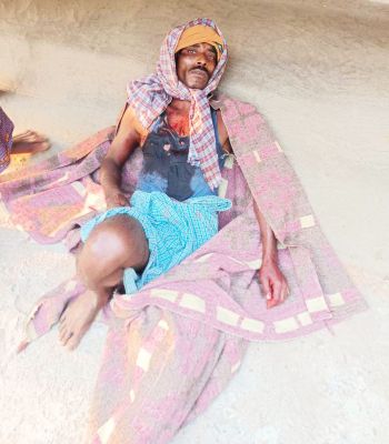 भालू के हमले से ग्रामीण घायल  बेल पत्ता तोडऩे गया था जंगल
