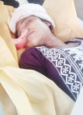 खाना बनाने पर विवाद: सो रही बड़ी बहन की हत्या