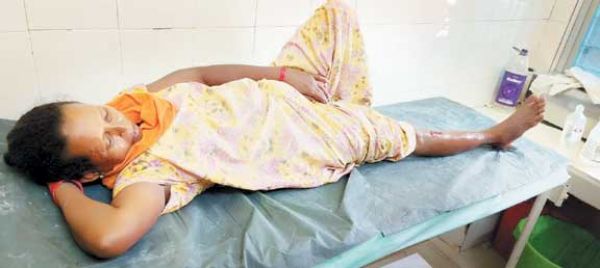 जंगली सूअर के हमले से महिला घायल, तेंदूपत्ता तोडऩे गई थी जंगल