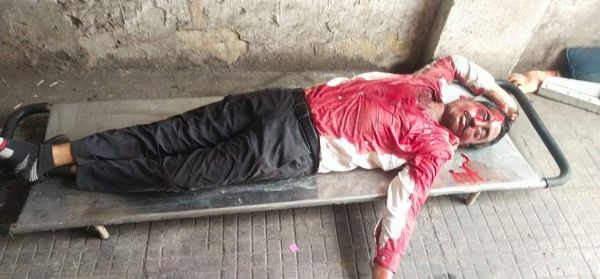 पिकअप की ठोकर से बाईक सवार की मौत, चालक घायल