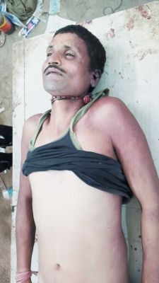 सर्प दंश से युवक की मौत