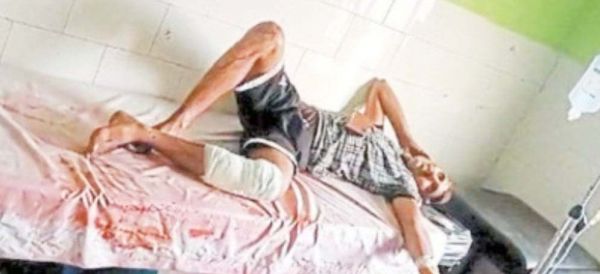 लूटपाट में असफल हो गए तो युवक को मार दी गोली