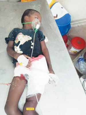 सडक़ हादसे में पिता पुत्र गंभीर, बोलेरो चालक फरार