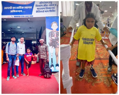 चिरायु से संवर रहा है जीवन, लक्ष्मी ने कृत्रिम पैरों से चलना किया शुरू