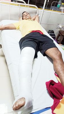 खराब सडक़ पर सिपाही गिरा परिवार  समेत पैर फैक्चर, पत्नी-बच्चे सुरक्षित