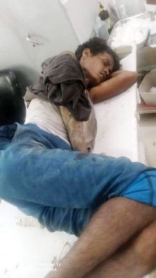 मिक्चर मशीन से कटा हाथ