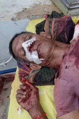 साउंड सिस्टम बजाने के विवाद में चाकूबाजी, 3 जख्मी