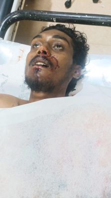 पुरानी रंजिश पर चाकू से हमला, मौत