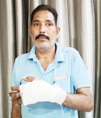 मेडिकल कॉलेज में मिला गलत इलाज,  हाथ काटने की आई नौबत