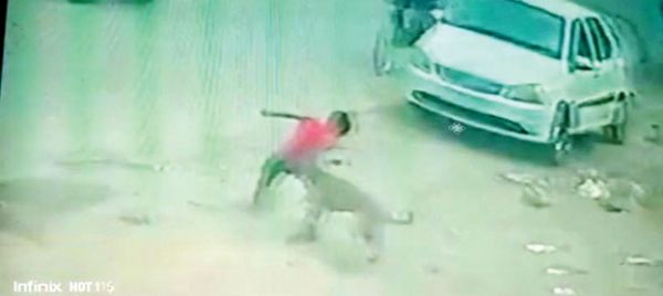शहर में कुत्तों का आतंक, मासूम को काटा