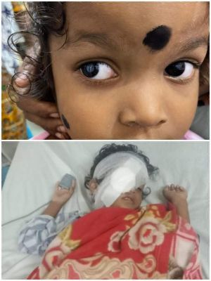 चिरायु योजना बना बच्चों  के लिए वरदान 