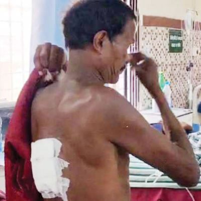 नशे में धुत भाभी ने कुल्हाड़ी से किया हमला, घायल