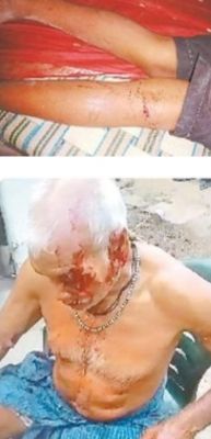 सियार ने अधेड़ सहित चार पर किया हमला