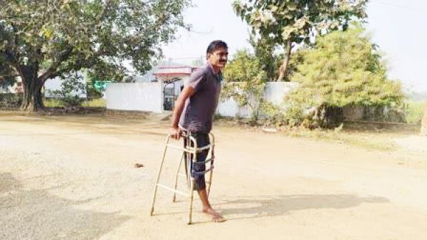 डॉक्टरों पर लापरवाही का आरोप, तीन सर्जरी के बाद काटना पड़ा पैर