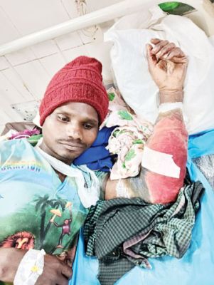 ग्रामीण पर भालू ने किया हमला