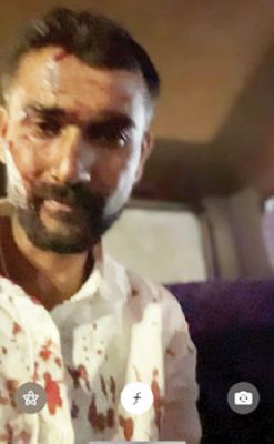 बाइक सवारों ने मारा कट, विवाद, युवा कांग्रेस नेता का सिर फोड़ा