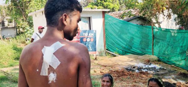 मां के सामने बेटे पर चाकू से हमला