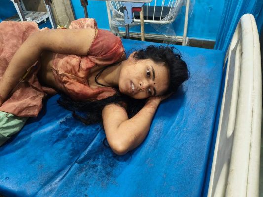 कुत्ता खरीदने पैसे न देने पर मां की  हत्या, पत्नी को घायल किया, फरार 