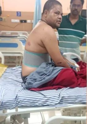  लकड़ी तस्करों की दबंगई, डिप्टी रेंजर पर कुल्हाड़ी से हमला