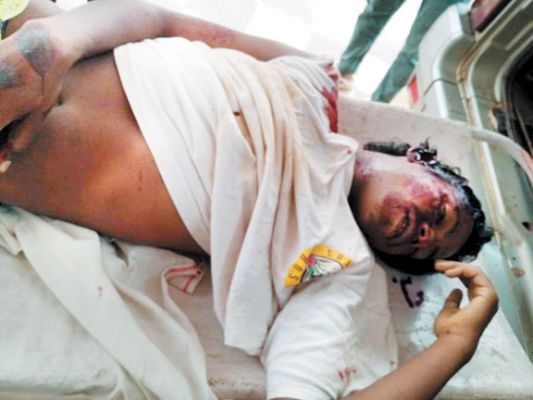 बाइक बिजली खंभे से जा टकराई, एक की मौत, दो गंभीर