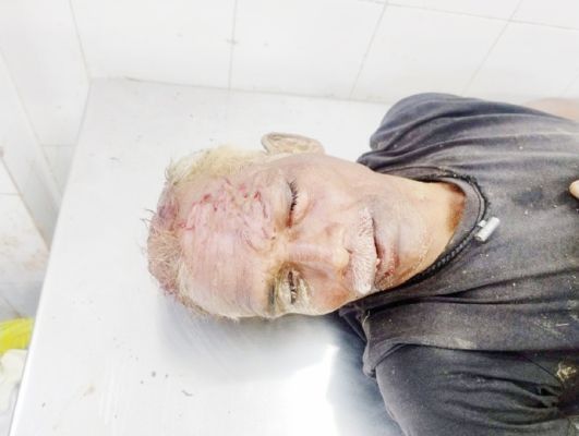 जमीन विवाद  चचेरे भाई पर प्राणघातक हमला
