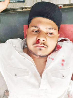 हत्या के आरोपी ने जमानत पर बाहर  आते ही साथियों संग सरेराह  युवक पर किया कातिलाना हमला