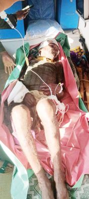  जंगल में पुटू लेने गए वृद्ध पर भालू ने किया हमला, गंभीर