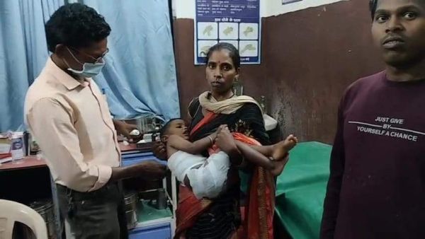 मासूम गरम चाय से झुलसा, गंभीर