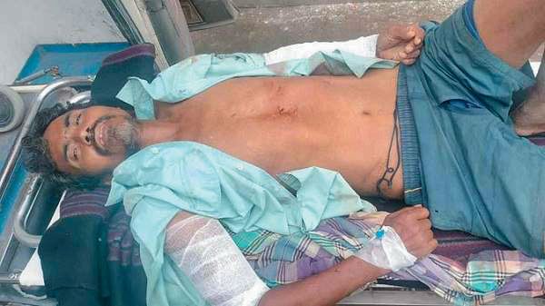 हाथी का हमला, ग्रामीण घायल
